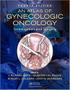 Imagem de An atlas of gynecologic oncology