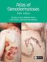 Imagem de Atlas of genodermatoses