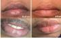 Imagem de Bálsamo Labial Clareador H.D.S.N. com Ácido Hialurônico - Kit com 2 Unidades