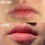 Imagem de Bálsamo Labial Lanolips 101 Ointment Multi-Balm - Duo com 2 Unidades de 15ml