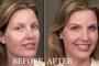 Imagem de Base Mineral Compacta Ageless Derma - Vegana e Sem Glúten (Bege Tranquilo)
