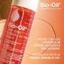 Imagem de Bio-Oil Tratamento Antiestrias Restaurador - 125ml VAL04/25