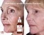 Imagem de Bloqmax Serum - Rejuvenescedor e tratamento facial