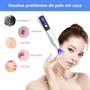 Imagem de Caneta de Plasma para Remoção de Manchas - 9 Níveis de Intensidade com Display LCD