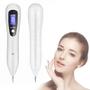 Imagem de Caneta de Plasma para Remoção de Manchas - 9 Níveis de Intensidade com Display LCD