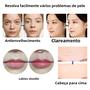Imagem de Caneta Hialurônica 2 em 1 (0,3/0,5ml) - Preenchimento Labial Sem Agulha