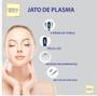 Imagem de Caneta Jato De Plasma Medical Beauty Acessorios - Anvisa