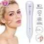 Imagem de Caneta Removedora de Manchas e Sardas - Limpeza Facial com Laser