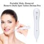 Imagem de Caneta Removedora de Manchas e Sardas - Limpeza Facial com Laser
