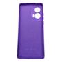 Imagem de Capa Capinha Compatível Motorola Edge 50 Fusion Xt2429 Tela