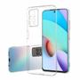 Imagem de Capinha Transparente Redmi 10 Normal - Produto Compatível