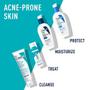 Imagem de CeraVe Acne Espumaing Cream Cleanser  Tratamento de Acne Lavagem Facial com 4% de Peróxido de Benzoílico, Ácido Hialurônico e Niacinamida  Fórmula creme para espuma  5 Oz