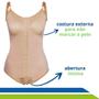 Imagem de Cinta Pós-Cirúrgica Body Modeladora com Colchetes Frontais e Alças Reguláveis Lipo HD, Abdominoplastia- 60602 - New Form