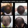 Imagem de Combo Antiqueda Engrossador Mini Hidrabell
