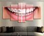 Imagem de Conjunto 5 Quadros Decorativos Dentista Aparelho "