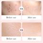 Imagem de Conjunto Rosarden Rose Facial de Cuidados com a Pele - 8 Unidades com Ácido Hialurônico