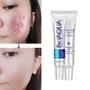 Imagem de Creme anti Acne cicatriz e manchas Bioaqua Pure Skin para pele mista e oleosa de 30g