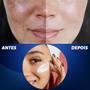 Imagem de Creme Clareador de Manchas Marcas Rosto Facial Dia 70 Fps Proteção Solar