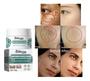 Imagem de Creme Clareador Removedor Melasma Sardas Manchas Eelhoe 30g