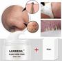 Imagem de Creme Lanbena Peeling De Tratamento P/ Cravos E Espinhas Kit Completo