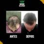 Imagem de Crescimento De Barba E Cabelo Beard Growth 60ml 