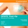 Imagem de Curativo Opsite Post-op 15,5cm x 8,5cm 66000712 1 Unidade Smith e Nephew 