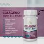 Imagem de Curcuma + colageno tipo ii com msm