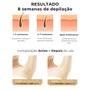 Imagem de Depilador com 5 Níveis de Intensidade para Corpo Inteiro e Rosto