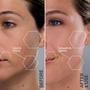 Imagem de Dermaplanador Sonicsmooth Michael Todd Beauty