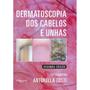 Imagem de Dermatoscopia dos cabelos e unhas