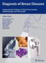 Imagem de Diagnosis of breast diseases - Thieme Publishers Inc/maple Press