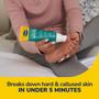 Imagem de Dr. Scholl'S Fast Acting Gel Removedor Calos Com Esfoliador
