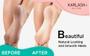 Imagem de Gel Removedor de Calos Karlash Professional - 120ml - Com Pedra-Pomes
