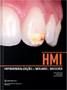 Imagem de Hmi: hipomineralizacao de molares e incisivos - ED NAPOLEAO