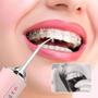 Imagem de Irrigador Jato de Limpeza Dental Oral Escova Dentes Eletrico Aparelho Ortodontico Higiene Bucal Gengiva Lingua Implante Dentario Protese