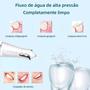 Imagem de Irrigador Oral Profissional Jato D'água Higiene Limpeza Bucal E Dental