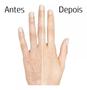 Imagem de Kit 03  Creme Mãos Sem Manchas Renew Clareador Textura Uniforme