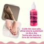 Imagem de Kit 2 Fitogel Gel de Arnica Alívio das Dores Musculares + 2 Loção para Tratar Pés Rachados  Milagroso Delima