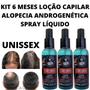 Imagem de Kit 3 Loção Spray Anti Caspa E Queda Fortalece Bulbo Capilar