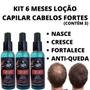 Imagem de Kit 3 Tônicos Liquido Em Spray Nasce Cresce E Trata Alopecia