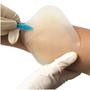 Imagem de Kit 4 Curativo Hidrocoloide + 1m Filme Adesivo Transparente Proteção Pele