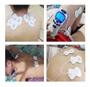 Imagem de Kit 4 Peças Adesivo Eletrodos Pads Aparelhos Fisioterapia Massagem Tens Fes