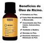 Imagem de Kit 5 Óleo De Rícino Natural Farmax 100% Puro 30Ml