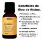 Imagem de Kit 6 Óleo De Rícino Natural Farmax 100% Puro 30Ml