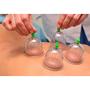 Imagem de Kit 6 Ventosas Copo Massageador Conjunto Para Massagem De Sucção Ventosaterapia Massoterapia