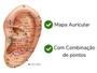 Imagem de Kit Acupuntura Auricular 16 Un Auriculoterapia Complementar