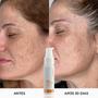 Imagem de Kit anti manchas e olheiras mizz clareador facial de manchas e melasmas anti bolsas e olheiras vasculares