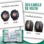 Imagem de Kit bioplex shampoo e tônico capilar nasce fios soft hair