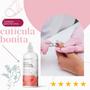 Imagem de Kit Com 3 Creme Removedor de Cutículas Labotrat Pro Removex Fortalece as Unhas 90gr