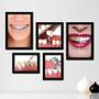 Imagem de Kit Com 5 Quadros Decorativos - Dentista Consultório - 185kq01p